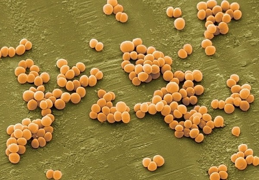 стафілокок